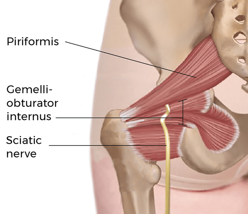 MJ21_DeepGlutealSyn2