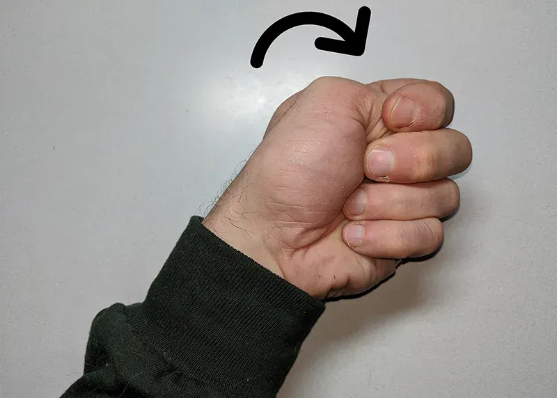 JF_21_ClinicalExplorations4