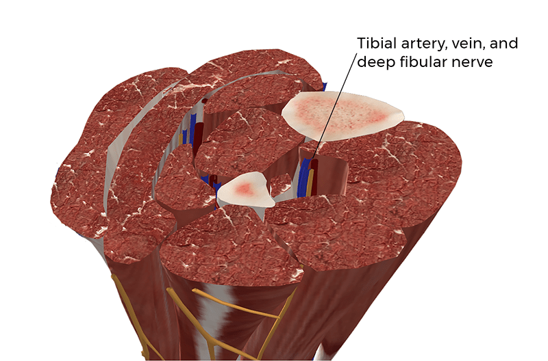 MA21_PuttingtheSqueeze3