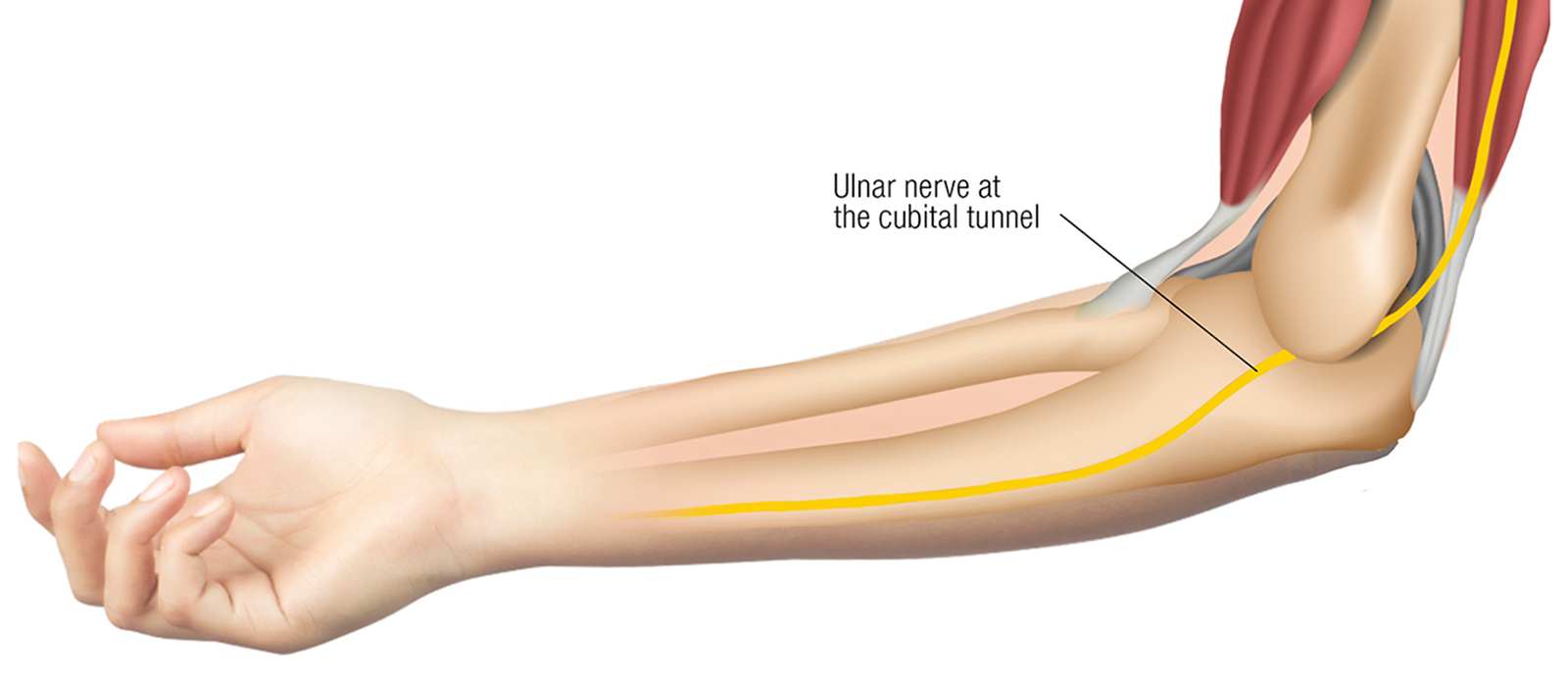 MJ20_Endangerment Sites7