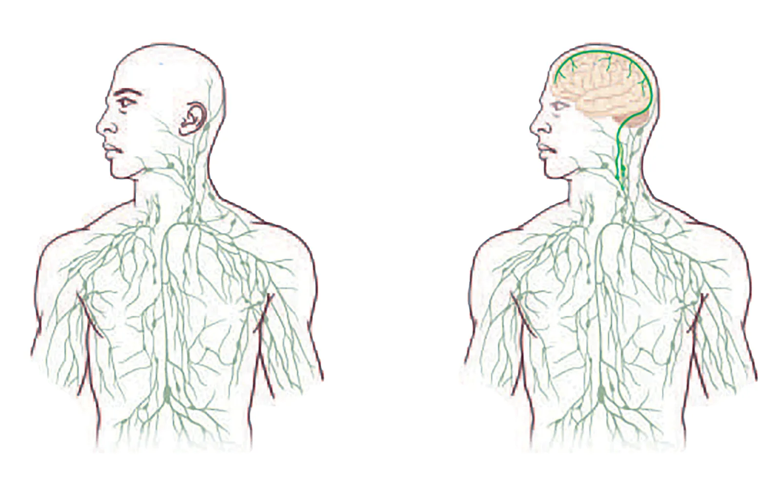 JF16_Lymph1