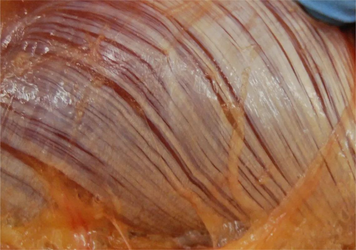 SO_16_LivingFascia_epimysium_Guimberteau_px1138