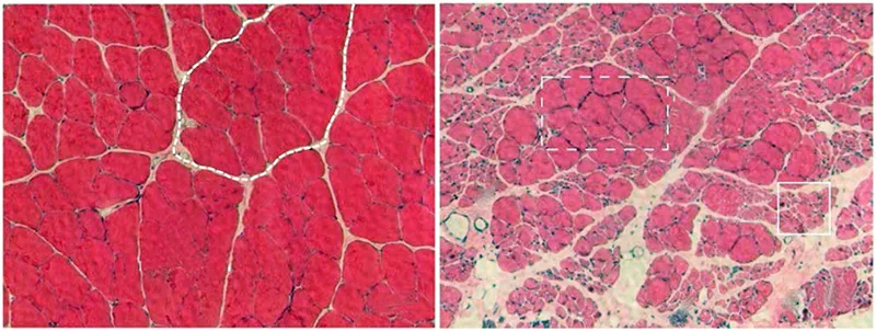 MA_19_SomaticEdgeAB_800